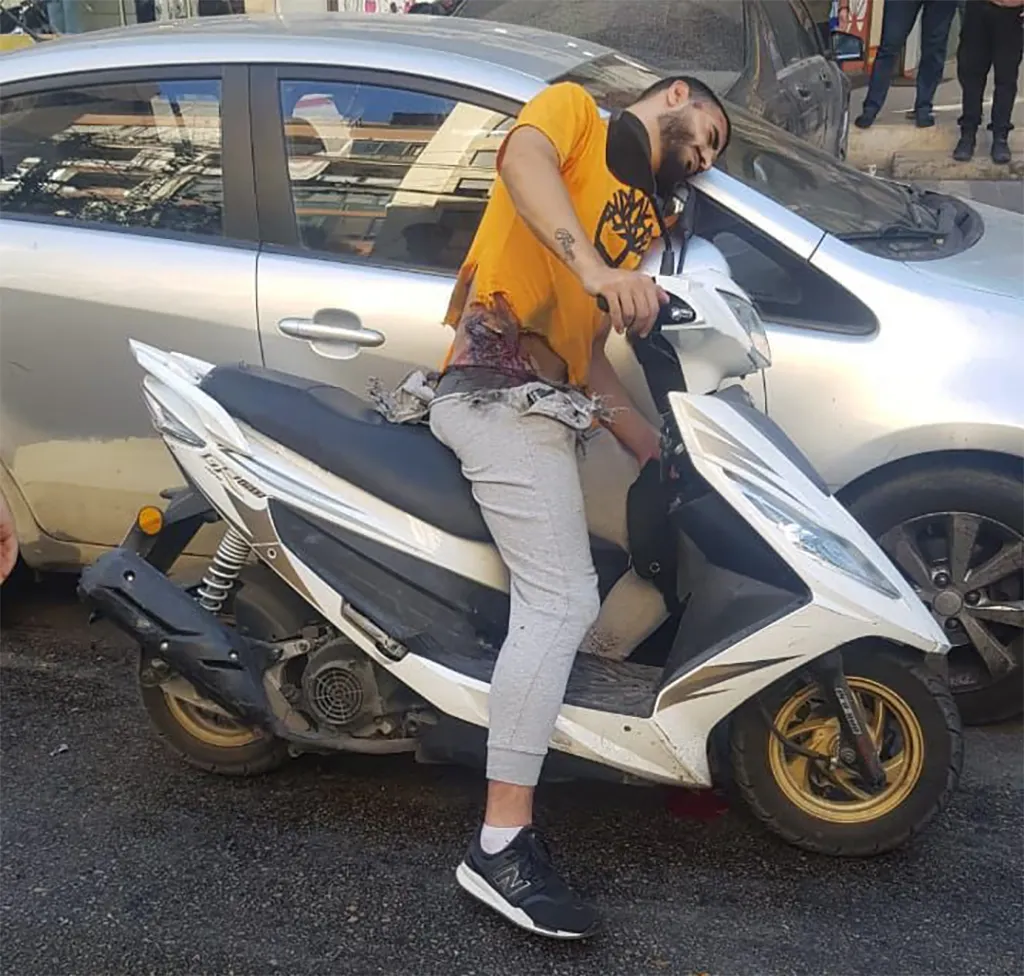 Ein Verletzter mit eher leichten Verletzungen auf einem Roller.