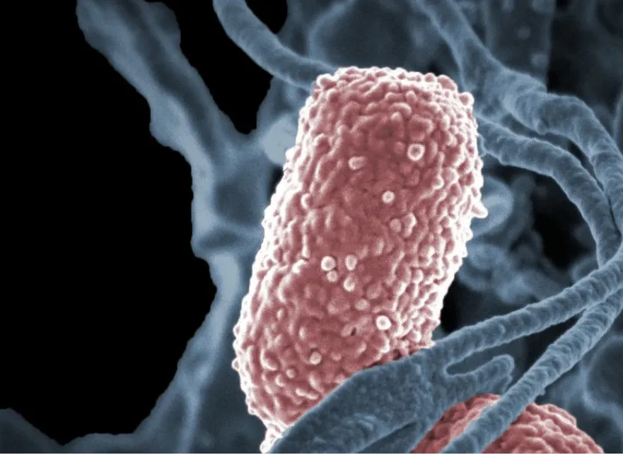 Klebsiella Pneumoniae gehört zu den normalen Darmbewohnern des Menschen - wie ihr Wirt haben Mikroorganismen auch einen Tag-und Nachtrhythmus. (Foto: NIH NAID /CC by 2.0)