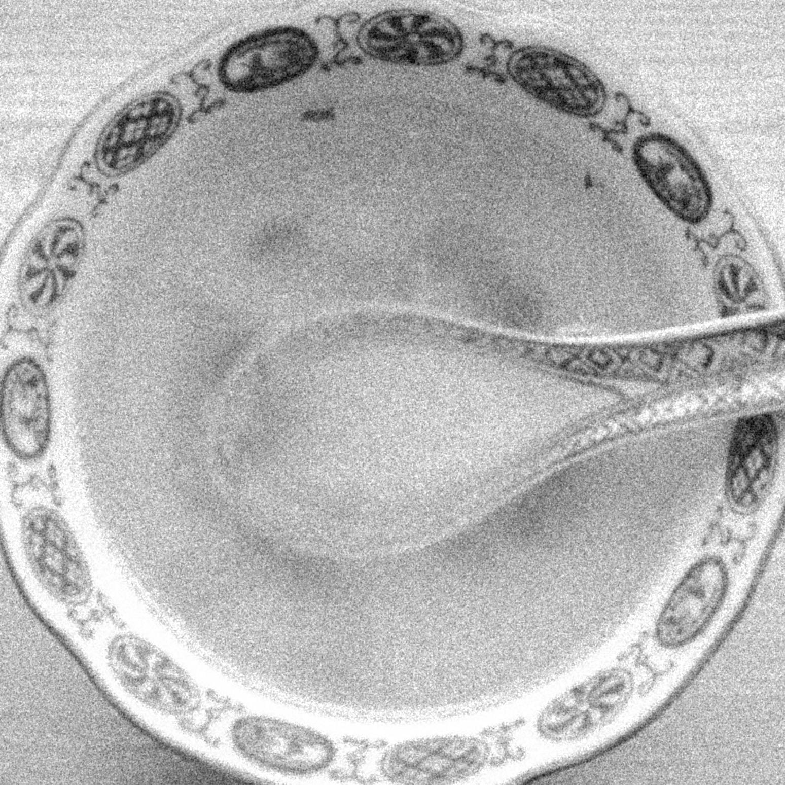 Trostsuppe ein Text über Hühnersuppe
