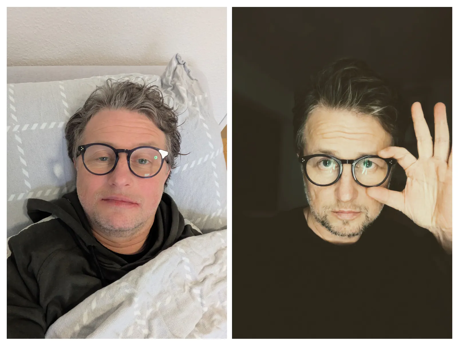 Zwei Selfies von mir. Im linken sehe ich schlimm aus, kurz nach meiner Weisheitszahn-OP. Im rechten versuche ich, so gut auszusehen, wie es geht.