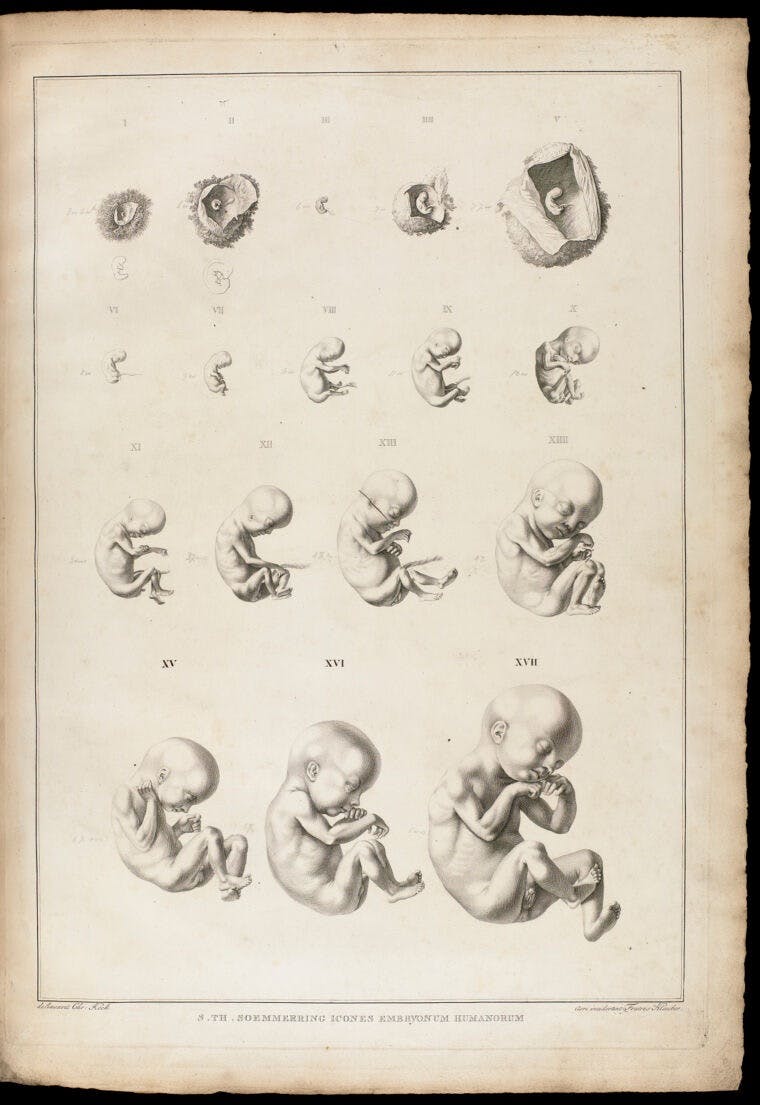 Zeichnung menschlicher Embryo in verschiedenen Stadien.